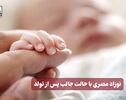 نورنما |نوزاد مصری با حالت جالب پس از تولد