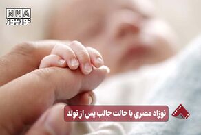 نورنما |نوزاد مصری با حالت جالب پس از تولد
