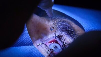 Iran ranks first in ophthalmology in West Asia, can compete with advanced countries