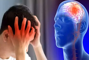 6 نشانه سکته مغزی کدامند؟