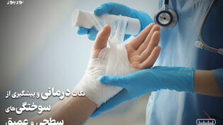 پادکست | نکات درمانی و پیشگیری از سوختگی های سطحی و عمیق