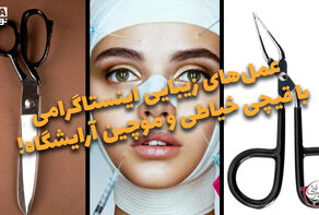 دوفوریتی | عمل‌های زیباییی اینستاگرامی با قیچی خیاطی و موچین آرایشگاه!