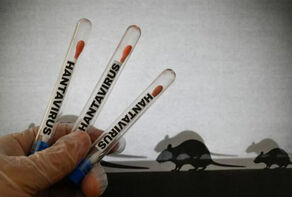 نخستین ابتلا به ویروس هانتا در تل‌آویو تأیید شد