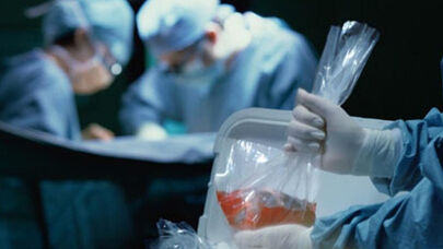 What Explains Iran Outperforming Canada and UK in Living Organ Donation?