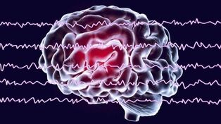 Iran develops smart device to measure depth of anesthesia