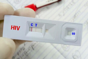 کاهش سهم «اعتیاد» در انتقال HIV؛ تغییر الگوی انتقال بیماری در ایران