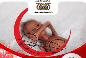 أرقام صادمة لعدد الضحايا الأطفال إثر العدوان السعودي على اليمن (صور)